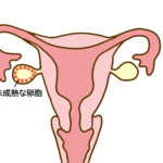 多嚢胞性卵巣症候群